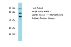 BRSK2 Rabbit anti-Human, Polyclonal, Novus Biologicals 0.1 mL | Buy Online | Novus Biologicals | Fisher Scientific